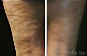 Ищу работу массажиста. #8228