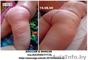 МАССАЖ В МИНСКЕ:т.8(029)6011735,  http://massage-minsk-2010.narod.ru #59845