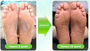 Педикюрные носочки BRAPHY. #1167189